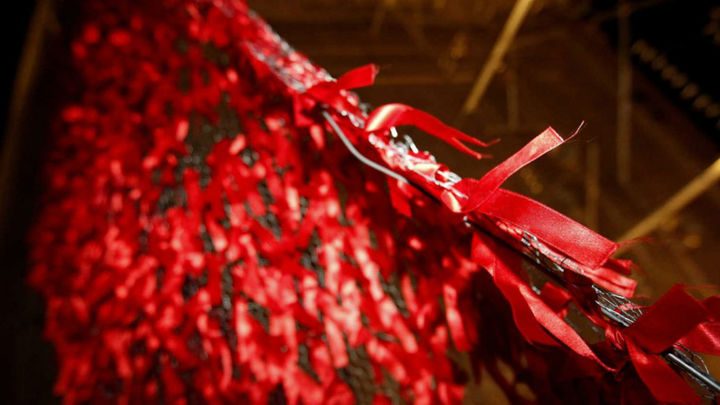 La investigación para frenar el envejecimiento prematuro  en personas con VIH / EFE