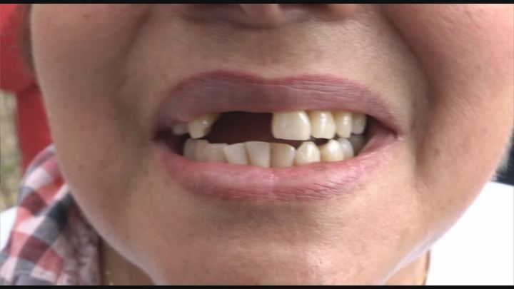 Afectados por Idental