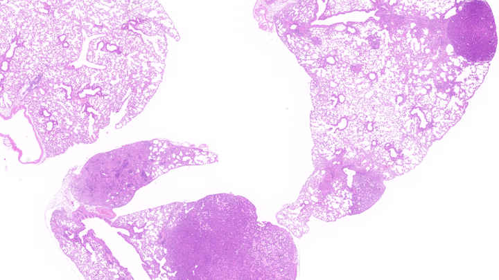 Tumor pulmonar inducido por KRAS4A / CNIO
