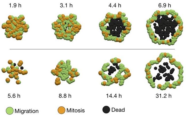 Evolución de células tumorales / UPM