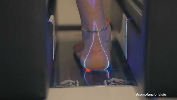 Estudio del pie / TeleMadrid