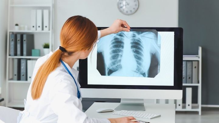 Cribado de cáncer de pulmón / ICAPEM