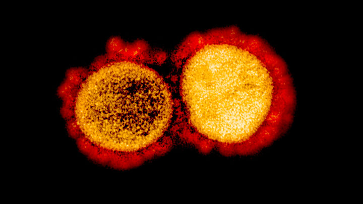 Así es el SARS-Cov-2 (micrografía electrónica) / EUROPA PRESS