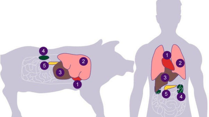 Xenotrasplante / CIENCIA